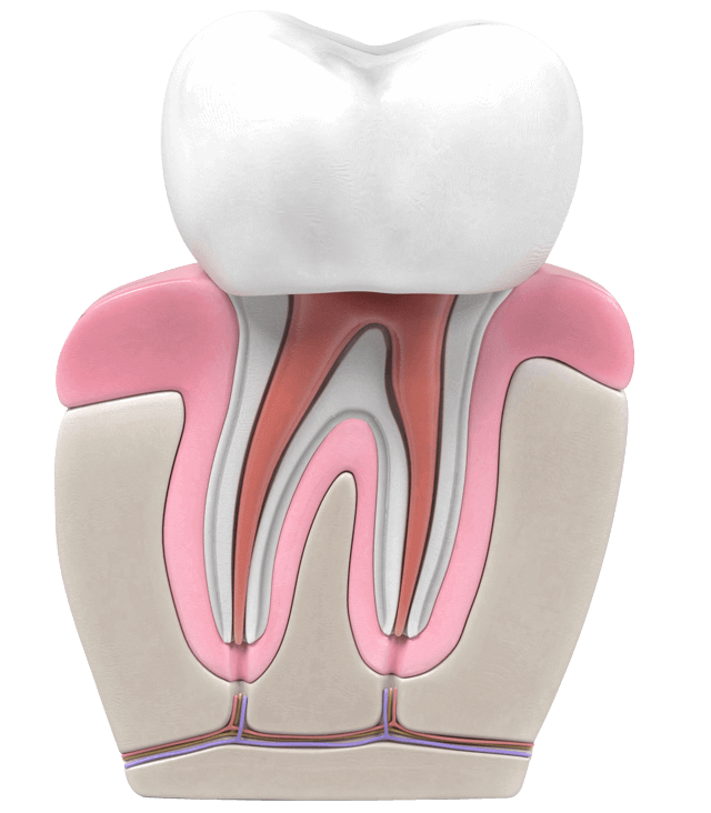 root canal cost Adelaide